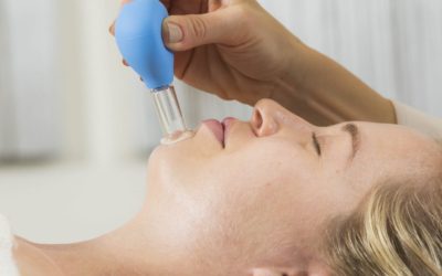 Facial Cupping